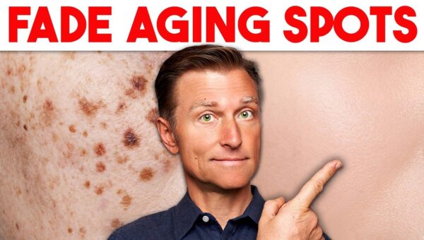 Beyond Aging Spots: Uncovering the Real Cause