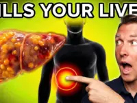 Fructose: The Hidden Liver Toxin You Eat Daily