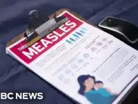 Measles Surges: US Faces Millions in Costs Amid Falling Vaccination