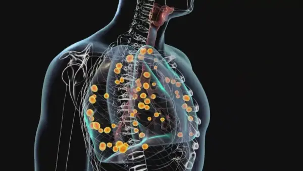 Mysterious Fungus Sickens Dozens in Tennessee Outbreak