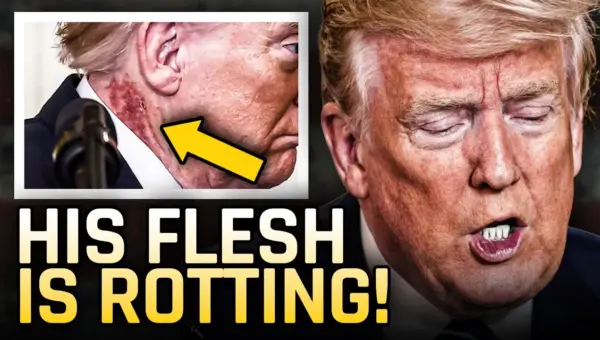 Trump’s Visible Decay: A Nation’s Unanswered Health Questions