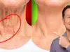 Lift Sagging Face: 2 Exercises Combat Turkey Neck