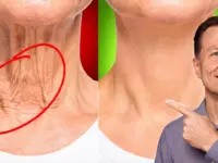 Lift Sagging Face: 2 Exercises Combat Turkey Neck