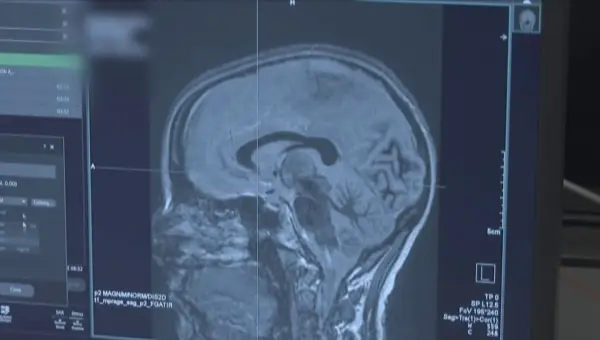 New Brain Tech Offers Hope for Parkinson’s Patients